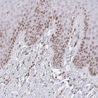 Anti-HOXC10 antibody produced in rabbit 