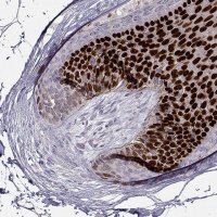 Anti-HOXC13 antibody produced in rabbit 