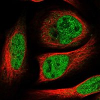 Anti-HOXC5 antibody produced in rabbit 