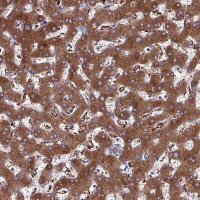 Anti-HP antibody produced in rabbit HPA047750-100UL
