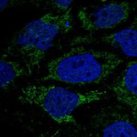 Anti-HPDL antibody produced in rabbit