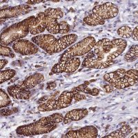 Anti-HPS6 antibody produced in rabbit 