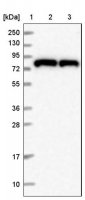 Anti-HPS6 antibody produced in rabbit 