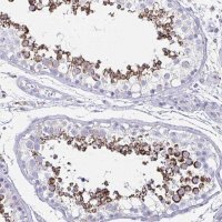Anti-HRASLS2 antibody produced in rabbit 