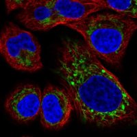 Anti-HRASLS2 antibody produced in rabbit 