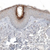 Anti-HRNR antibody produced in rabbit 