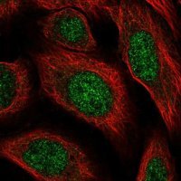 Anti-HS6ST2 antibody produced in rabbit HPA034626-100UL