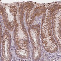 Anti-HSBP1L1 antibody produced in rabbit 