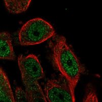 Anti-HSBP1L1 antibody produced in rabbit 
