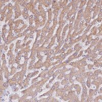 Anti-HSD17B7 antibody produced in rabbit 
