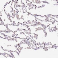 Anti-HSD17B7 antibody produced in rabbit 