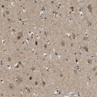 Anti-HSPA13 antibody produced in rabbit 