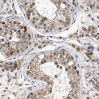 Anti-HSPA13 antibody produced in rabbit 