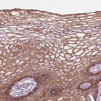 Anti-HSPA14 antibody produced in rabbit 