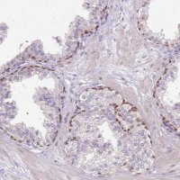 Anti-HSPA1A antibody produced in rabbit 