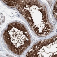 Anti-HSPA6 antibody produced in rabbit 