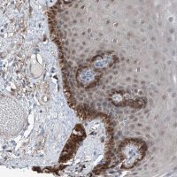 Anti-HSPA6 antibody produced in rabbit 