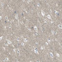 Anti-HTR1F antibody produced in rabbit 
