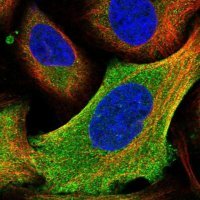 Anti-HYI antibody produced in rabbit 