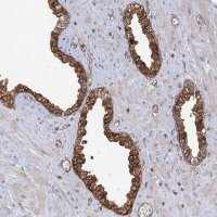 Anti-IDI1 antibody produced in rabbit 