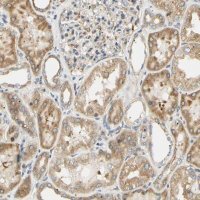 Anti-IER3IP1 antibody produced in rabbit HPA010027-100UL