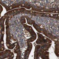 Anti-IFFO2 antibody produced in rabbit HPA015987-100UL