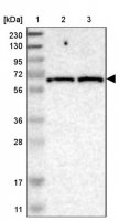Anti-IFFO2 antibody produced in rabbit HPA015987-100UL