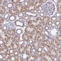 Anti-IFIT1 antibody produced in rabbit 