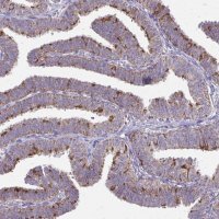 Anti-IFIT1 antibody produced in rabbit 