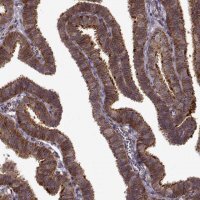 Anti-IFRD2 antibody produced in rabbit HPA068560-100UL