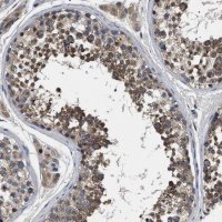 Anti-IFT81 antibody produced in rabbit 