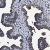 Anti-IFT81 antibody produced in rabbit 