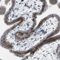 Anti-IGF2R antibody produced in rabbit