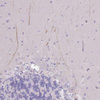 Anti-IGFL4 antibody produced in rabbit 