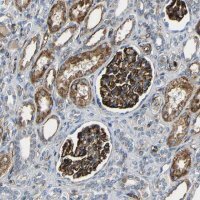 Anti-IGSF10 antibody produced in rabbit 