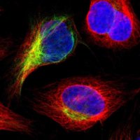 Anti-IGSF10 antibody produced in rabbit 