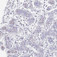 Anti-IGSF23 antibody produced in rabbit 