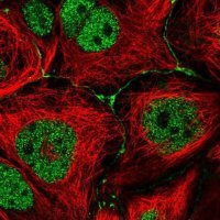 Anti-IGSF23 antibody produced in rabbit 
