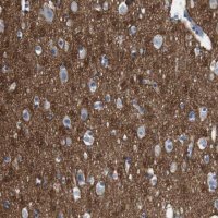 Anti-IGSF8 antibody produced in rabbit HPA011917-100UL