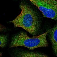 Anti-IKBKAP antibody produced in rabbit HPA049677-100UL