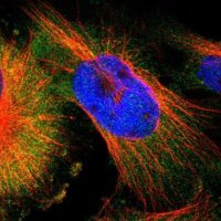 Anti-IKBKG antibody produced in rabbit 