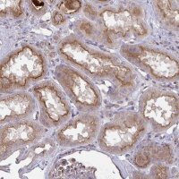 Anti-IL1R1 antibody produced in rabbit 