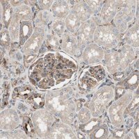 Anti-IL1RL1 antibody produced in rabbit 