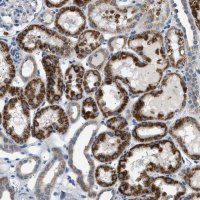 Anti-ILDR1 antibody produced in rabbit 