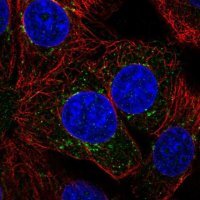 Anti-ILVBL antibody produced in rabbit 