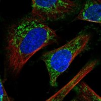 Anti-IMMP2L antibody produced in rabbit 