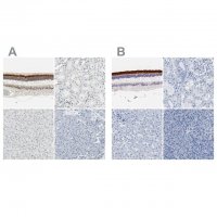 Anti-IMPG2 antibody produced in rabbit 