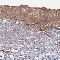 Anti-INO80D antibody produced in rabbit HPA043976-100UL