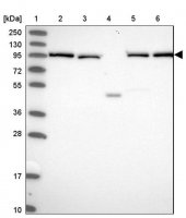 Anti-INO80D antibody produced in rabbit HPA043976-100UL