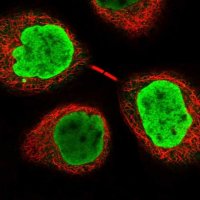 Anti-INO80E antibody produced in rabbit 